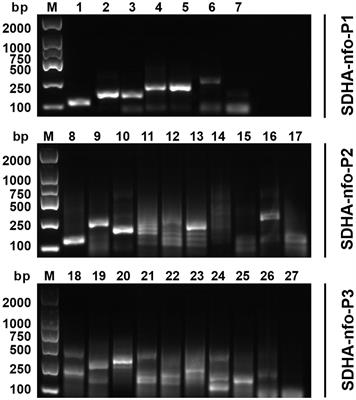 Recombinase polymerase amplification - lateral flow dipstick for rapid and visual detection of Blastocystis spp.